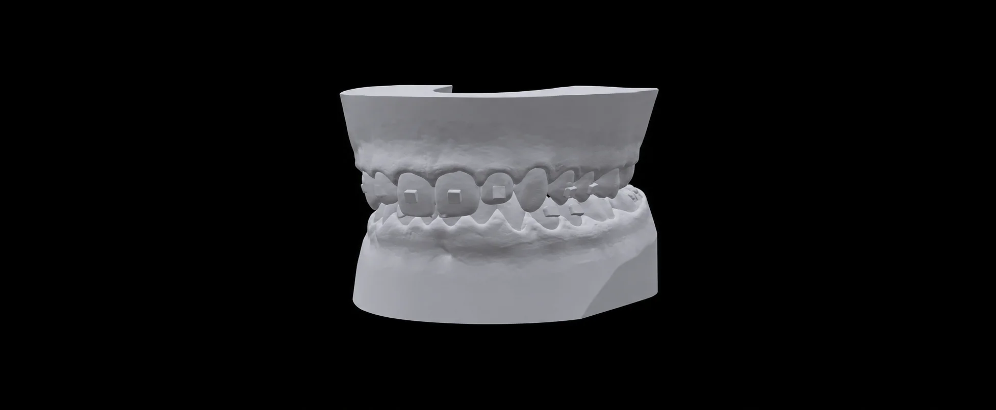 Visor 3D interactivo con modelo dental a pantalla completa